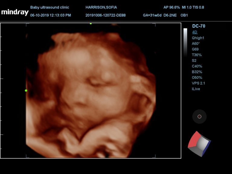 201910061213030009OB | Baby Ultrasound Clinic